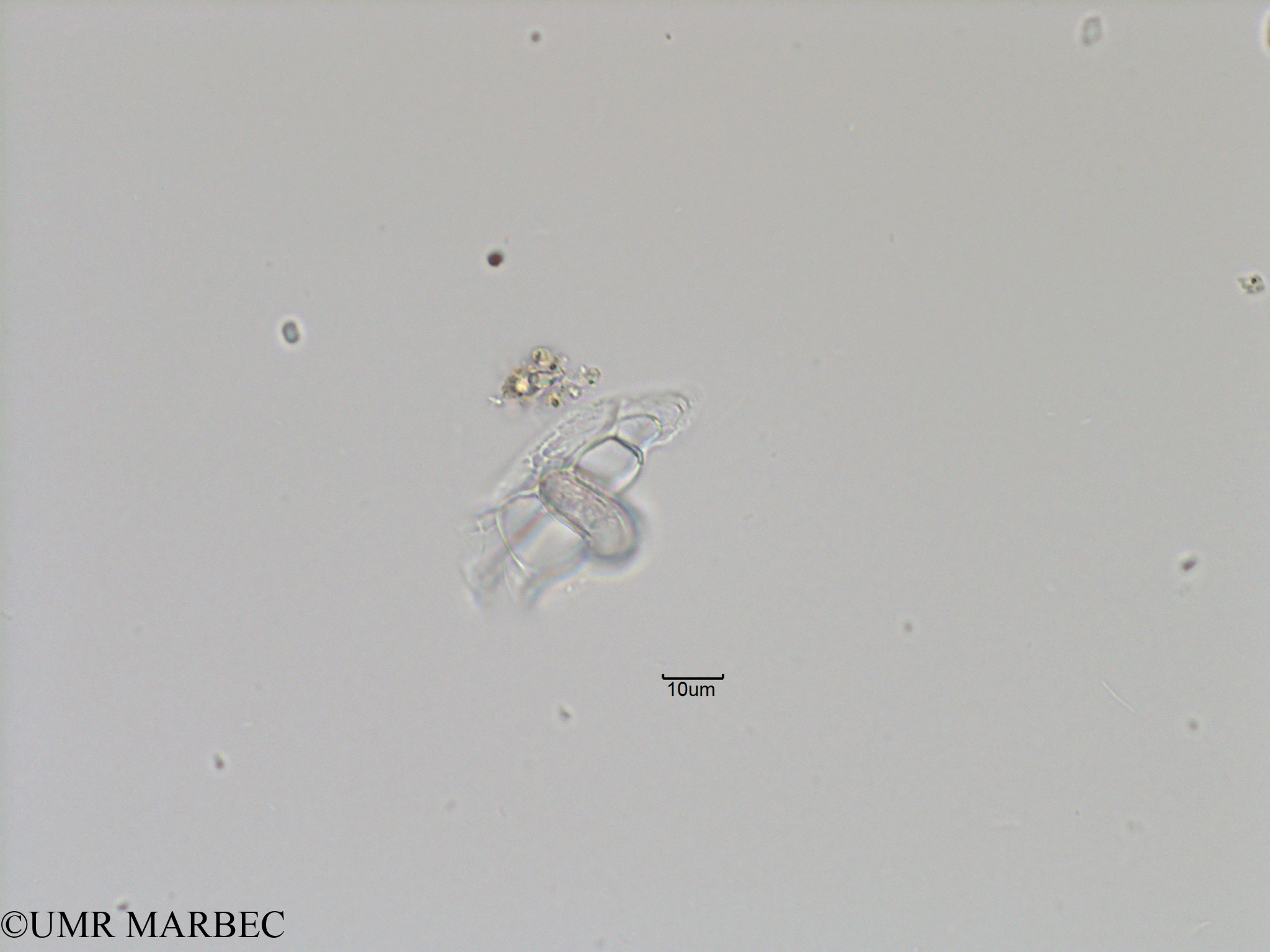 phyto/Bizerte/bizerte_bay/RISCO November 2015/Histioneis sp1 (Baie_T5-C2-Histioneis-1).tif(copy).jpg